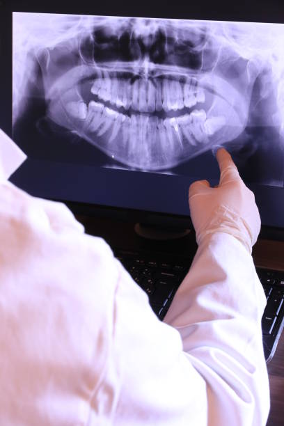 Best Emergency Tooth Extraction in Ogden Dunes, IN